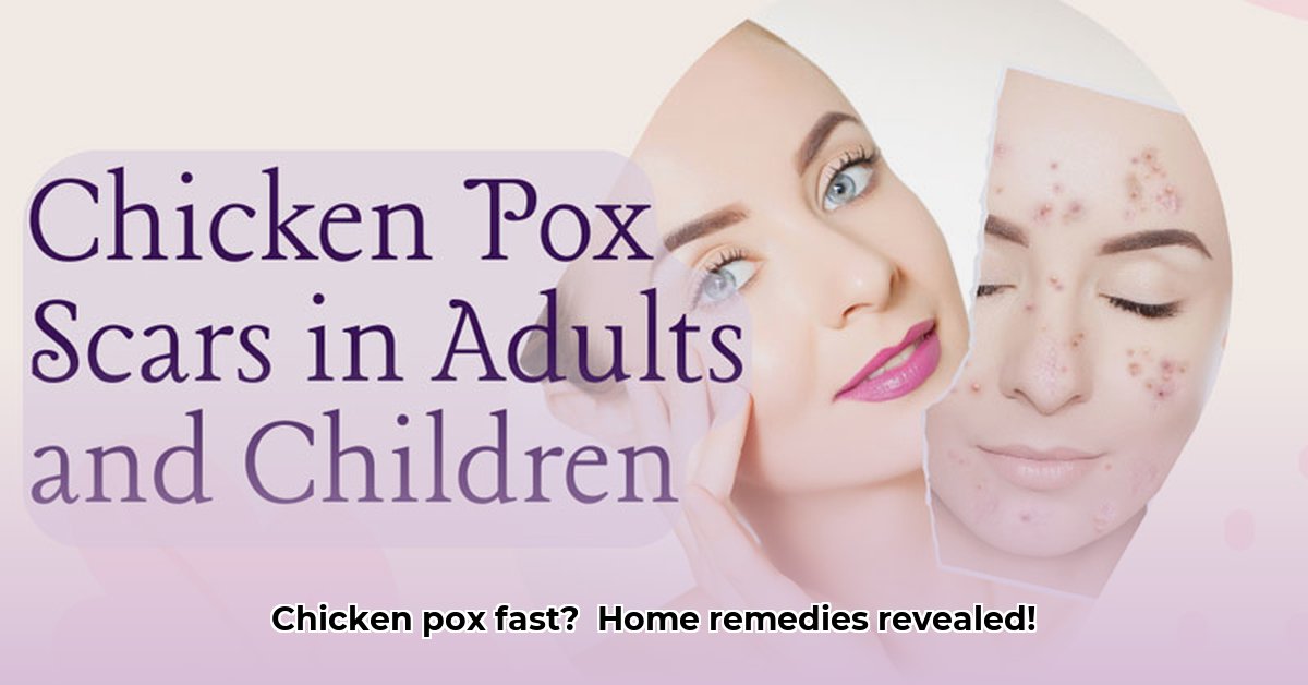 how-to-cure-chicken-pox